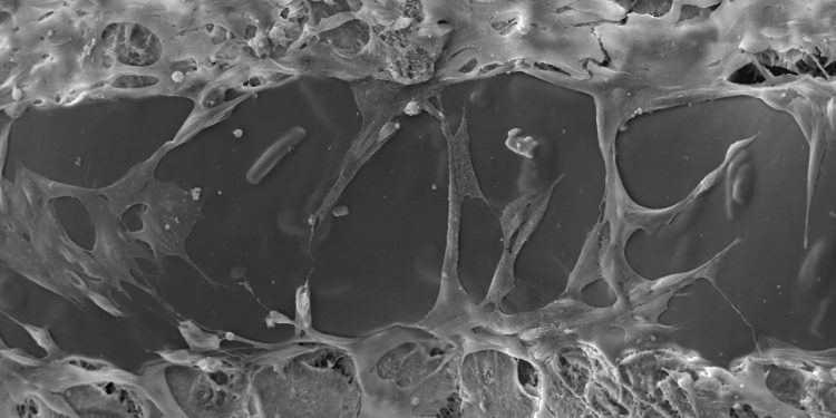 Учени разработват нови материали  за ортопедични импланти