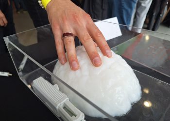Мозъчните импланти помагат и срещу депресия
